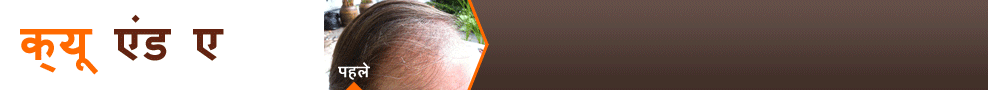 Treatment For Gray Hair